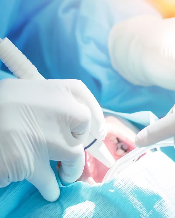 Endodontic Surgery